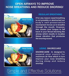 SnoreCare – Advanced Premium Nose Vents 